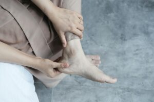 Obrzęki nóg – przyczyny, diagnostyka i postępowanie