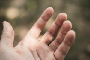 Recepta online na łuszczycę – jak wygląda konsultacja online